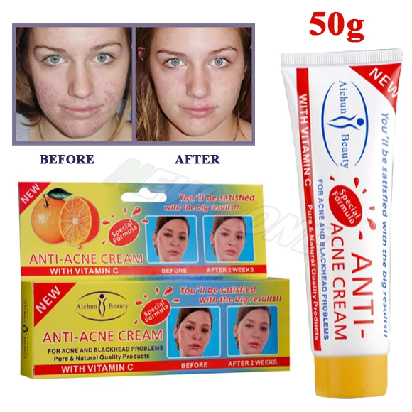 face pimple cream man