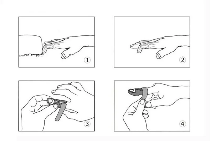 6 шт./компл. медицинский палец фанера совместных приталенный оборудование, восстановливающее здоровье Ортез на палец ручной ортопедическая Ортопедия