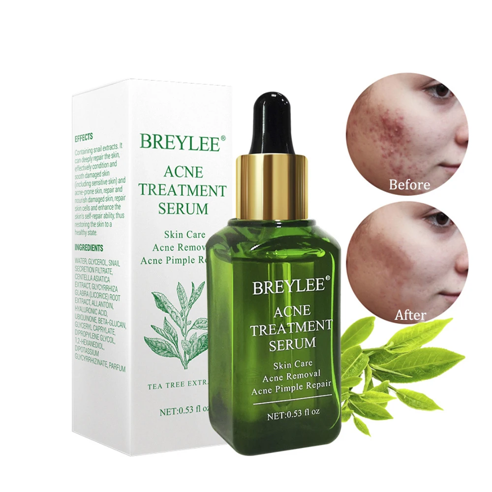 

Facial Essence Anti Acne Scar Removal Cream Treatment Face Skin Care Whitening Repair Pimple Remover For Blackhead Acne Serum