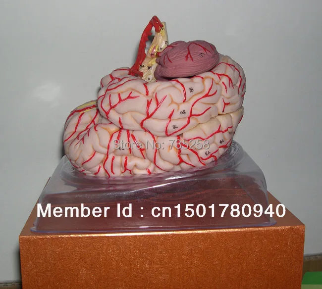 Brain Artery Model,Brain Anatomical Model,Cerebral Artery Dissection Model Brain Artery Model,Brain Anatomical Model,Cerebral Artery Dissection Model