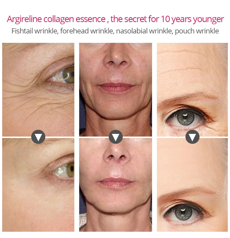 15 мл Argireline collagen Six Peptides Сыворотка против морщин для ухода за кожей лица средства для ухода за кожей лица антивозрастная Сыворотка для лица Прямая