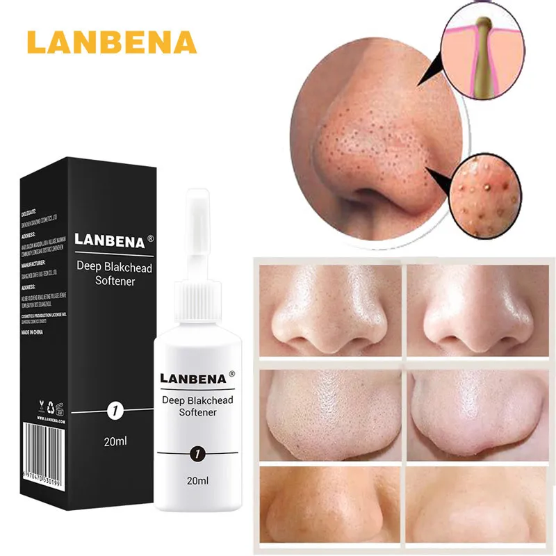 LANBENA Deep Blackhead смягчитель производное жидкое эссенция средство для устранения