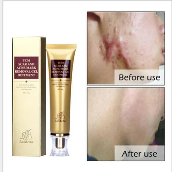 

LANBENA Acne Scar Cream Ginseng Essence Anti Acne Remover Cream Face Care Makeup Spots Stretch Marks Remove Scar Dropship 10pcs