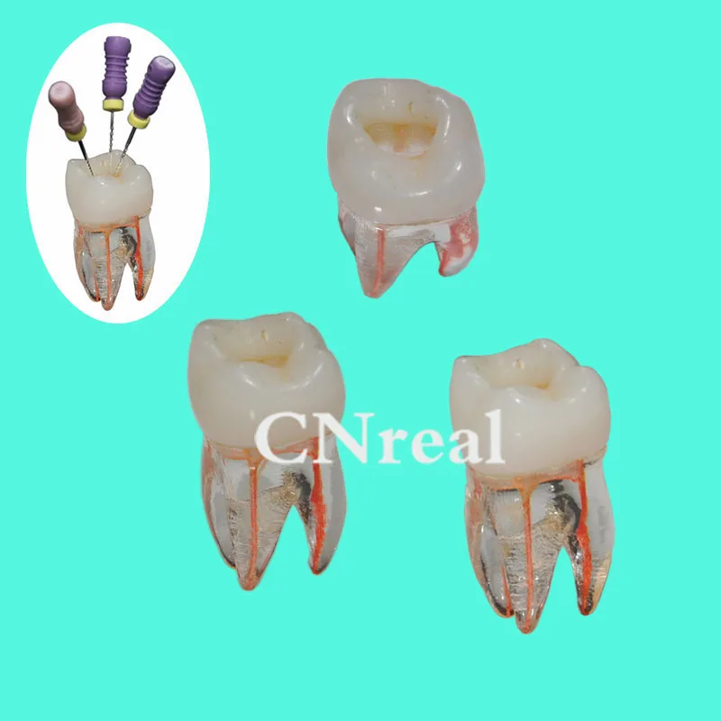 3 шт./лот зуб корневой канал зубы модель для RCT практики прозрачная смола с целлюлозной полости и окрашенный корневой канал