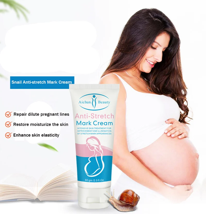 stretch marks hatane ki cream