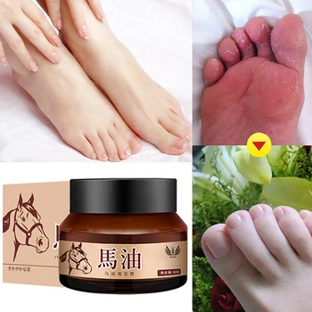 

Effective beriberi Treatment Cream Horse Oil Feet Cream Care Feet Itch Blisters Anti-chapping Peeling Bad Foot Ointment