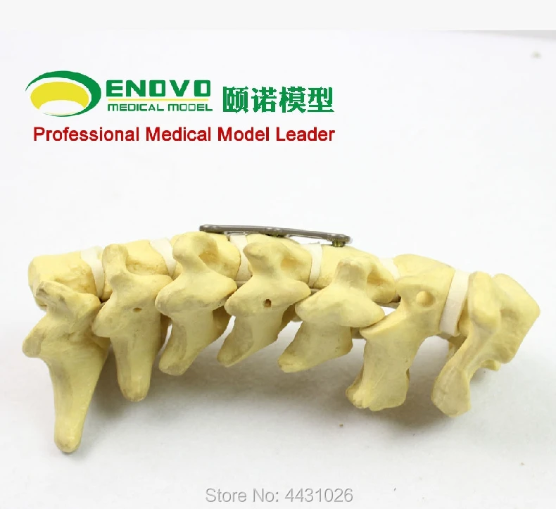 ENOVO Human Cervical Spine Model Anatomy Model Spine Statues Medical Science Teaching