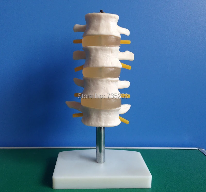 Поясничный набор(4 шт.) модель поясничного отдела позвоночника