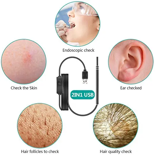0.3MP Endoscope Zoomable Otoscope Medical Ear Care