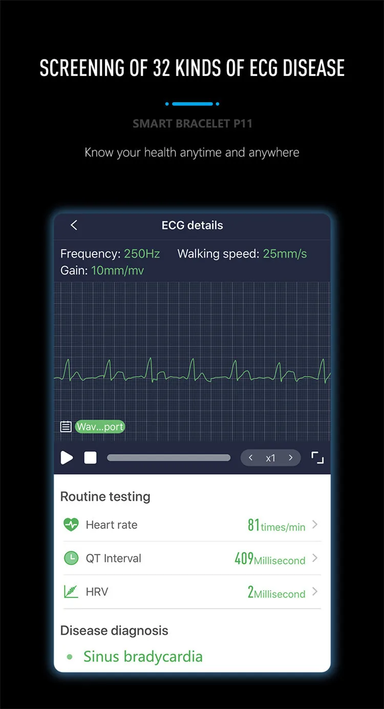 Hembeer H11 смарт-браслет ЭКГ+ HRV точный пульсометр кровяное давление кислородный монитор Часы Браслет pk Fitbits