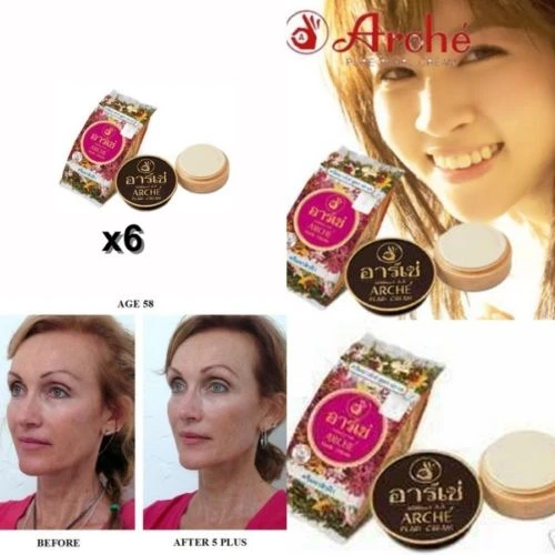 arche cream for acne
