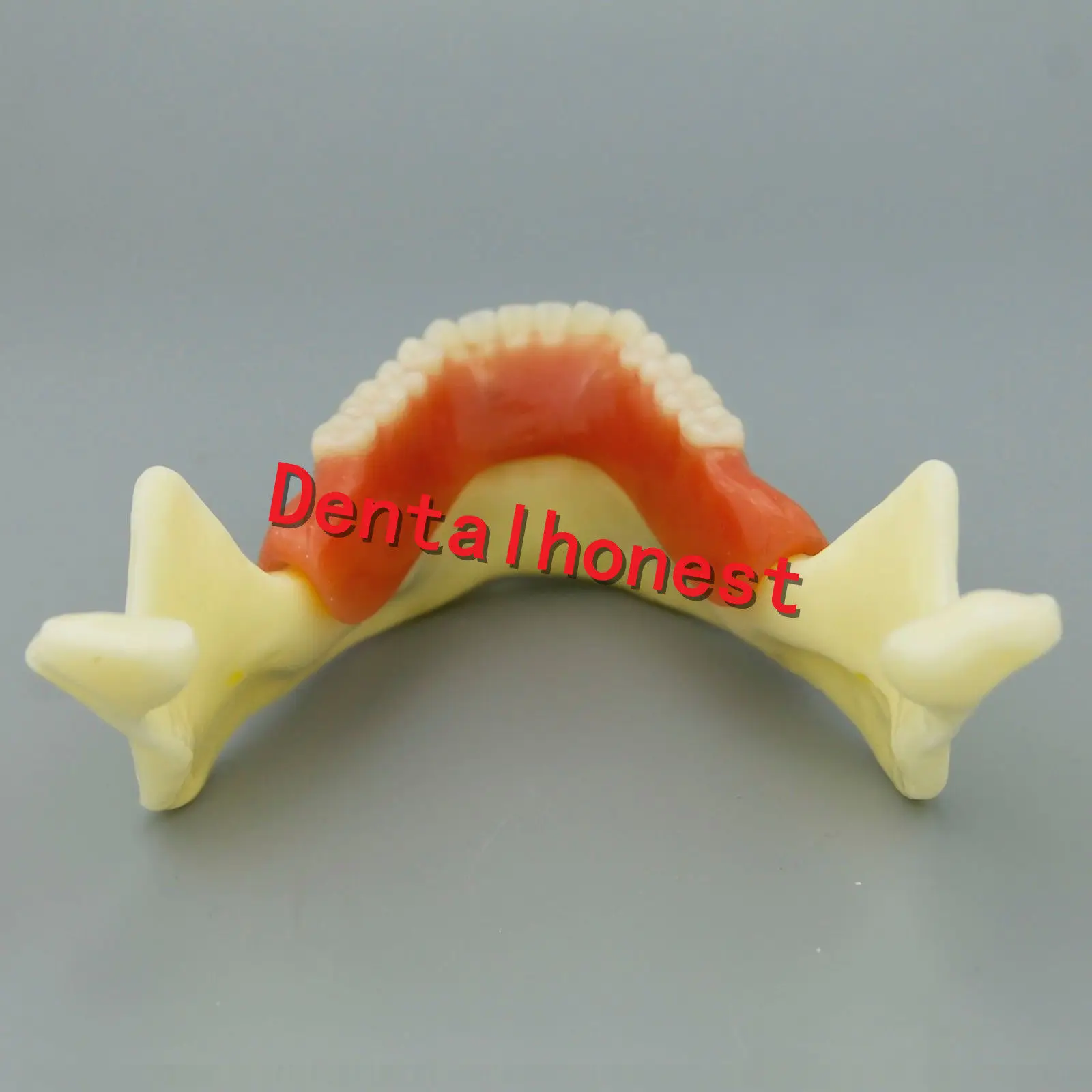 Зубная мандибль имплантат сверхпротез модель зубов с сосудов демонстрационная модель