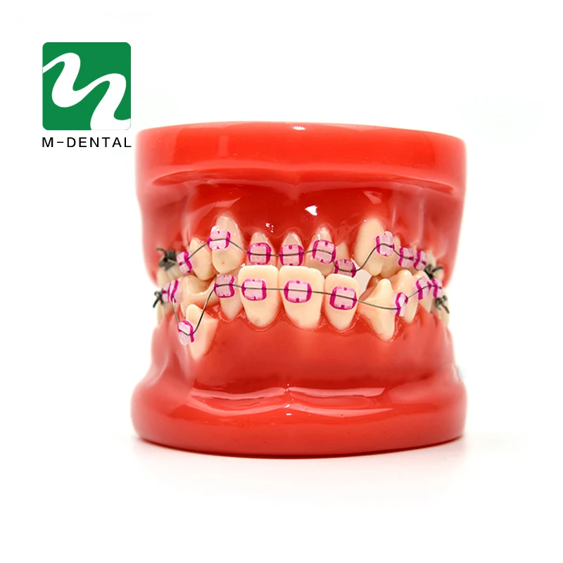 

Orthodontic Model 28 Unit Teeth With Half Metal Bracket And Half Ceramic For School Training Study And Communicate With Patients