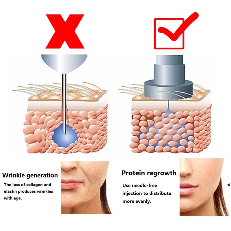 Новейший пистолет без иглы для мезотерапии, распылитель гиалуроновой ручки, ручка для губ, кожный наполнитель, инжектор, против морщин, мезо, гиалуроновая кислота, ручка
