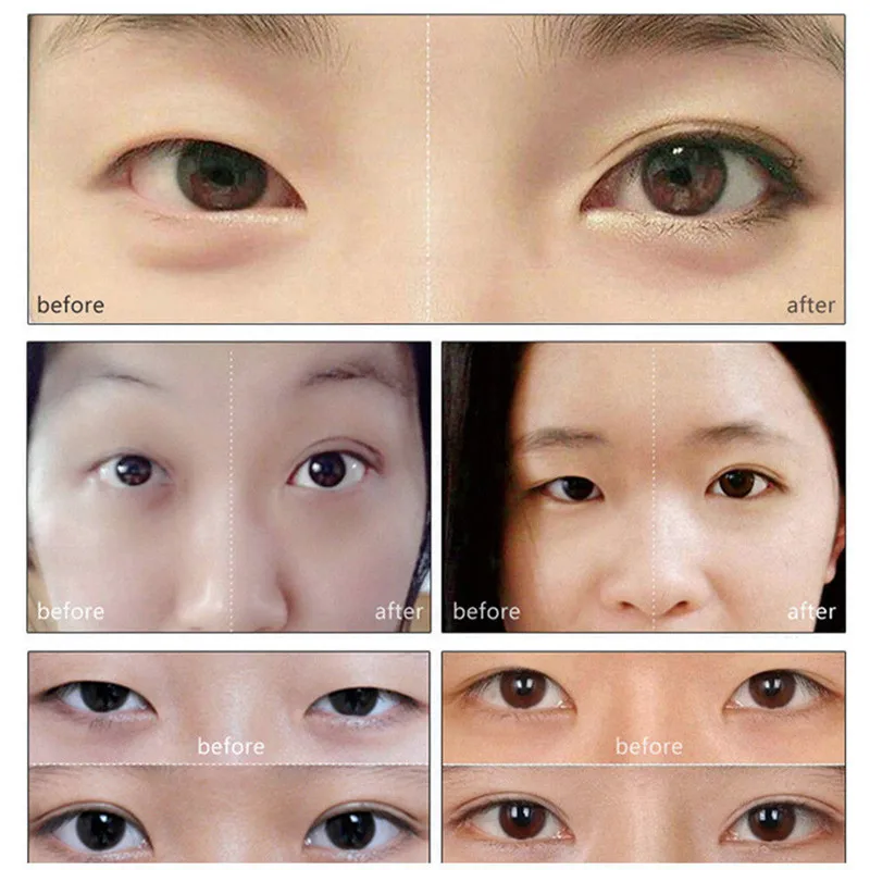 Double eyelid sticker Invisible Fiber Double Side Adhesive Eyelid