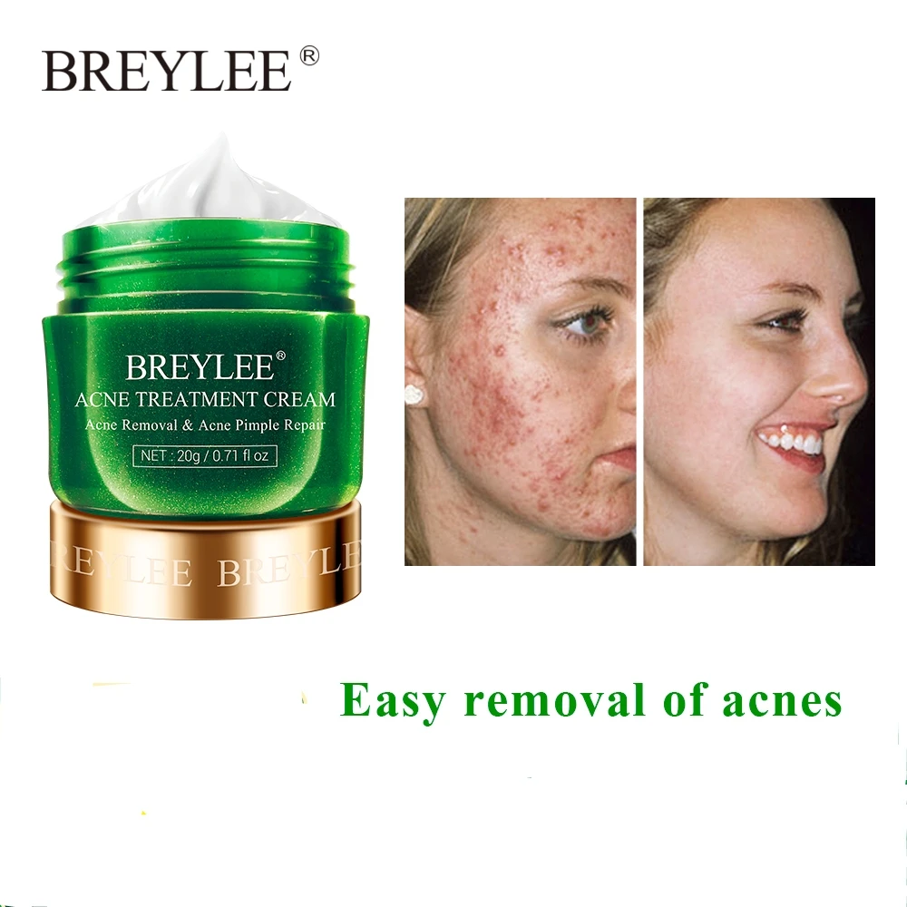 

BREYLEE Acne Treatment Cream Anti Acne Face Cream Pimple Removal Spots Oil Control Shrink Pores Moisturizing Skin Care Serum 20g