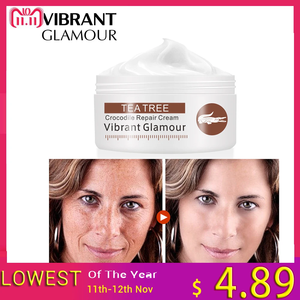 Crocodile Pigment Correct Facial Cream Scar Repair Acne Scars Mark Remover Skin Lightening Face Cream Whitening Remove Dark Spot