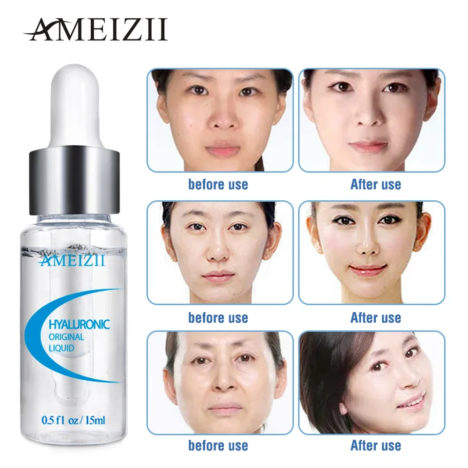 ameizii hyaluronic acid