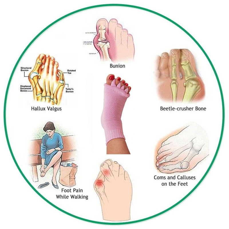 1Pair Five Toe Socks Bunion Corrector Orthotics Separators for Hallux Valgus Pain Relief Foot Care Pedicure Tools