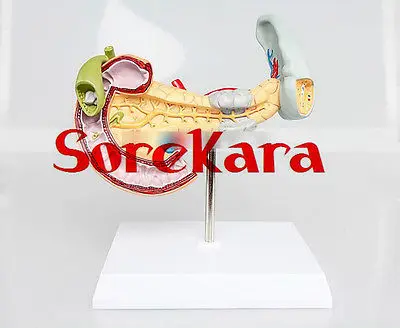 

Human Anatomical Pancreas Duodenum Diseased Organ Dissection Medical Teach Model School Hospital