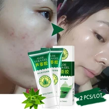 2 шт./партия крем для лица Кюрасао алоэ вера гель от акне лечение Влажный Ремонт после солнца Гладкий для увлажнения увлажняющий отбеливающий кожу