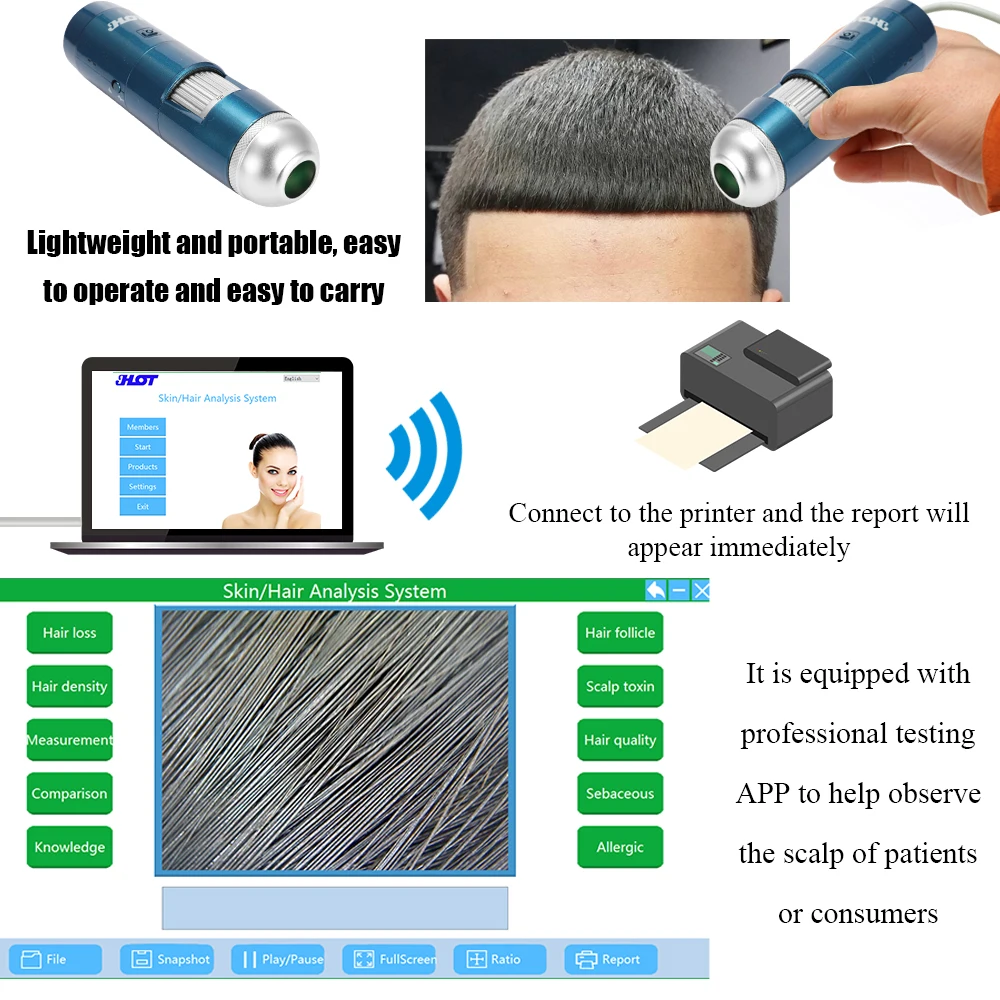 HT-BW30 5-200X Регулируемый HD скин волосяные фолликулы прибор для исследования кожи волосистой части головы Wi-Fi бытовой портативный скины тестер