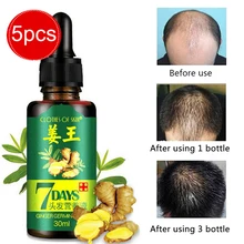 5 шт./компл. для роста волос волосы потерь жидкости чистый Эфирное Масла плотные волосы рост Сыворотки волос растет быстрее