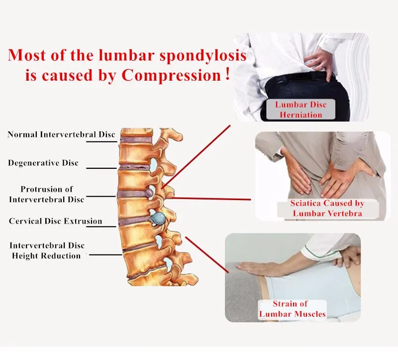 Поясничный Электрический пояс с воздушным давлением, надувная тяга, предотвращающая выздоровление, поясничный позвонок, которая снимает боль