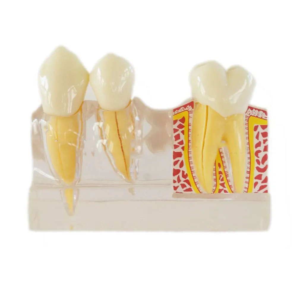 4X Time Disassembling Teeth Model Dental Study Material to Show Cuspid