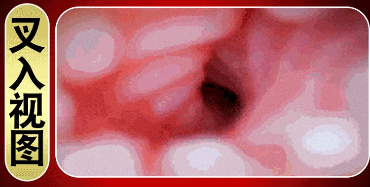 1 (7)