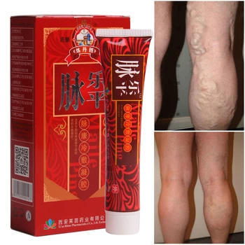 

Varicose Veins Treatment Cream Ointment Vasculitis Angiitis Phlebitis Spider Veins Pain Remedy Herbal Body Cream Drop Shipping