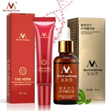 Травяное Лечение ногтей onychomicosis Paronychia против грибковой инфекции ногтей хороший результат Китайский Травяной Уход за ногтями