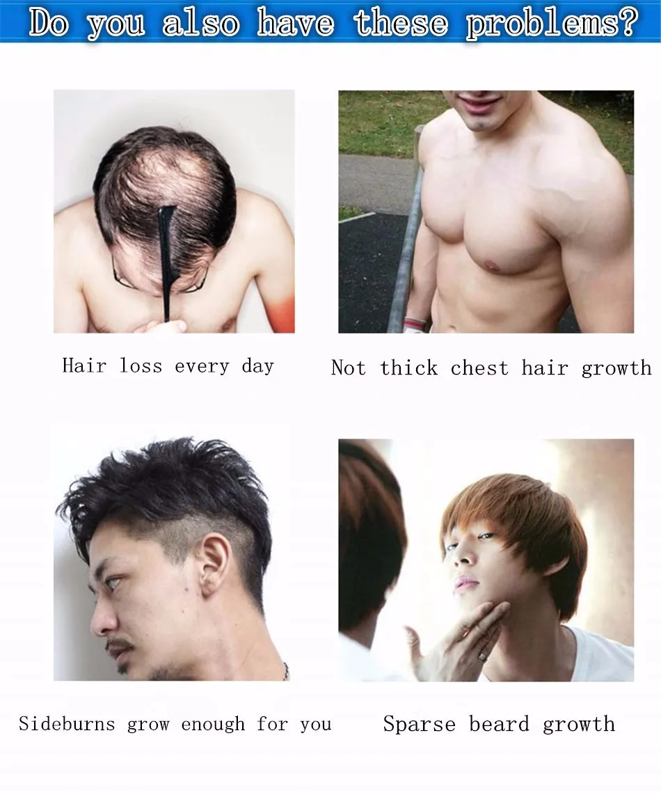 Beard Growth Oil 20ml Fast Hair Grow Products For Alopecia Pubic