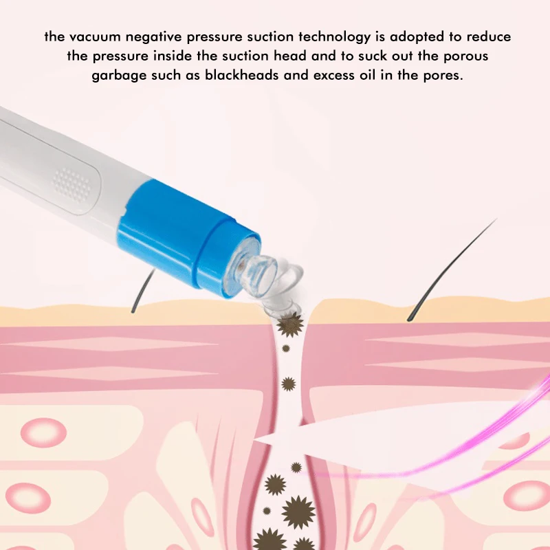 Электрический вакуумный прибор для удаления угрей, очиститель пор для лица, лечение акне, инструменты для ухода за лицом, косметический инструмент