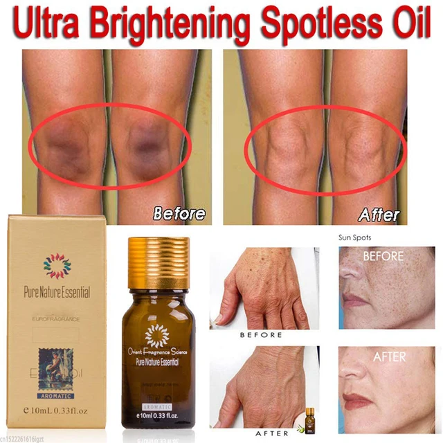 Ultra Brightening Spotless Essence Oil Skin Care Dark Spots Remove Ance Burn Strentch Marks Scar Removal Brightening US Stock