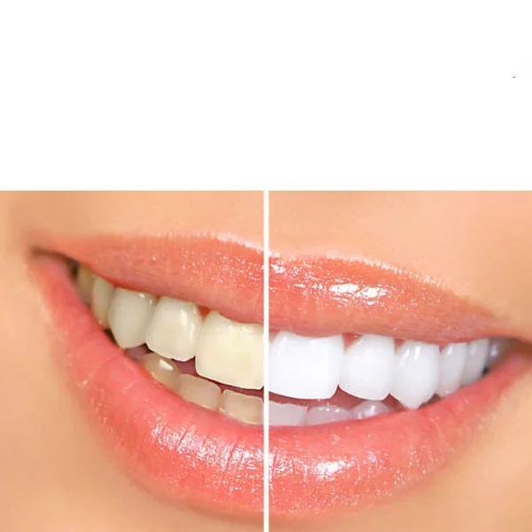 Popular-White-Teeth-Whitening-Pen-Tooth-Gel-Whitener-Bleach-Remove-Stains-oral-hygiene-HOT-SALE