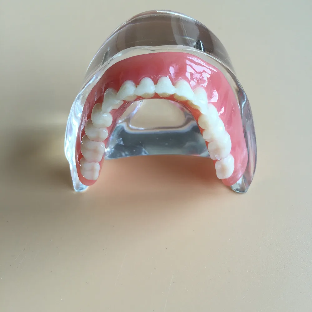 Модели зубных протезов. Съемный пластмассовый протез. Модель зубов. Съемный протез (3-5 зубов) термо джет. Съемный протез (6-14 зубов) термо джет.