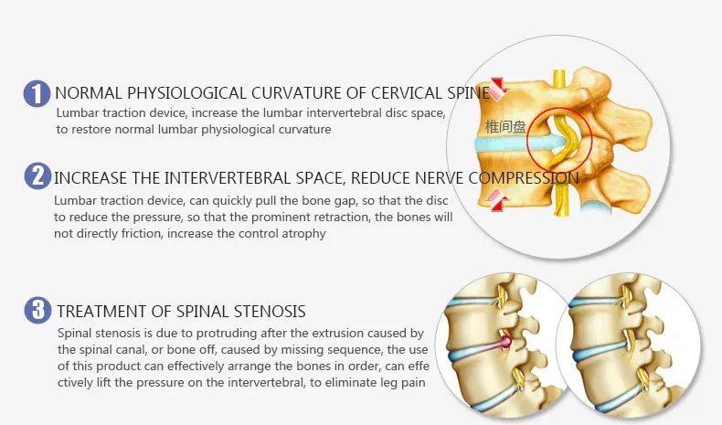 Запатентованная Хорошая Эффективная Шейная спина поясница позвоночника тяга кровать терапия массаж тела растягивающее устройство для Lumbago боли в спине