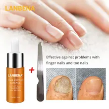 LANBENA Nail Repair Essence Serum Fungal Nail Treatment Remove Onychomycosis Toe Nourishing Brighten Hand Foot Skin Care 12ml