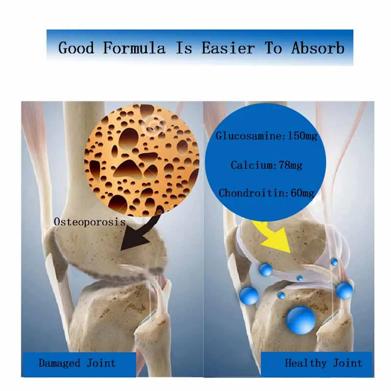 Glucosamine Chondroitin Protective Joint For Old People Increase Bone Density Relieve pain Bone Care