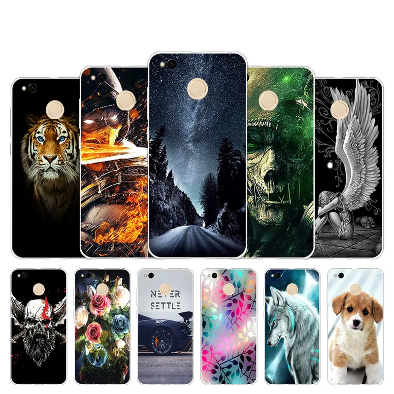 for Xiaomi Redmi 4X Capa Transparent Luxury Silicone TPU Phone Cases 5&quot Coque Back Cover Slim Fashion Shell | Мобильные телефоны