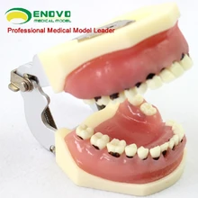 

Dental Severe Dentistry Periodontal Model Dental calculus Scaling Gingival suture Model Dividing