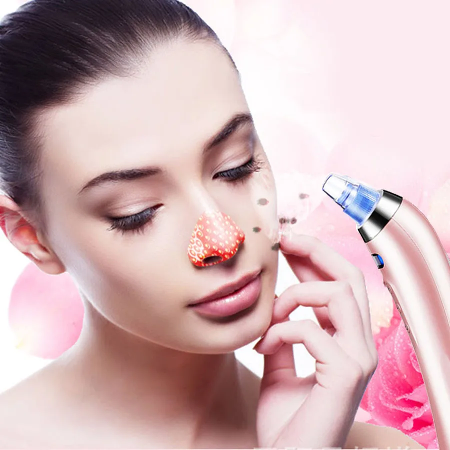 acne pimple extractor