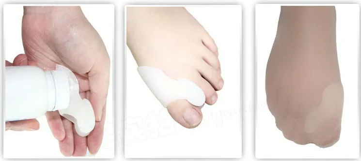 1 пара Силиконовый корректор для пальцев ног сепаратор для большого пальца ноги Рассекатель Облегчает боль в ногах исправление шишки на ноге Защита Подушка фитнес