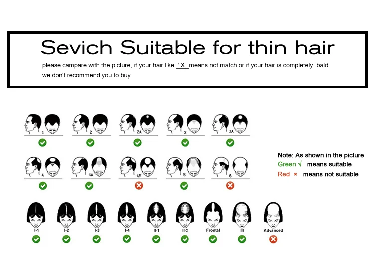 sevich--_09