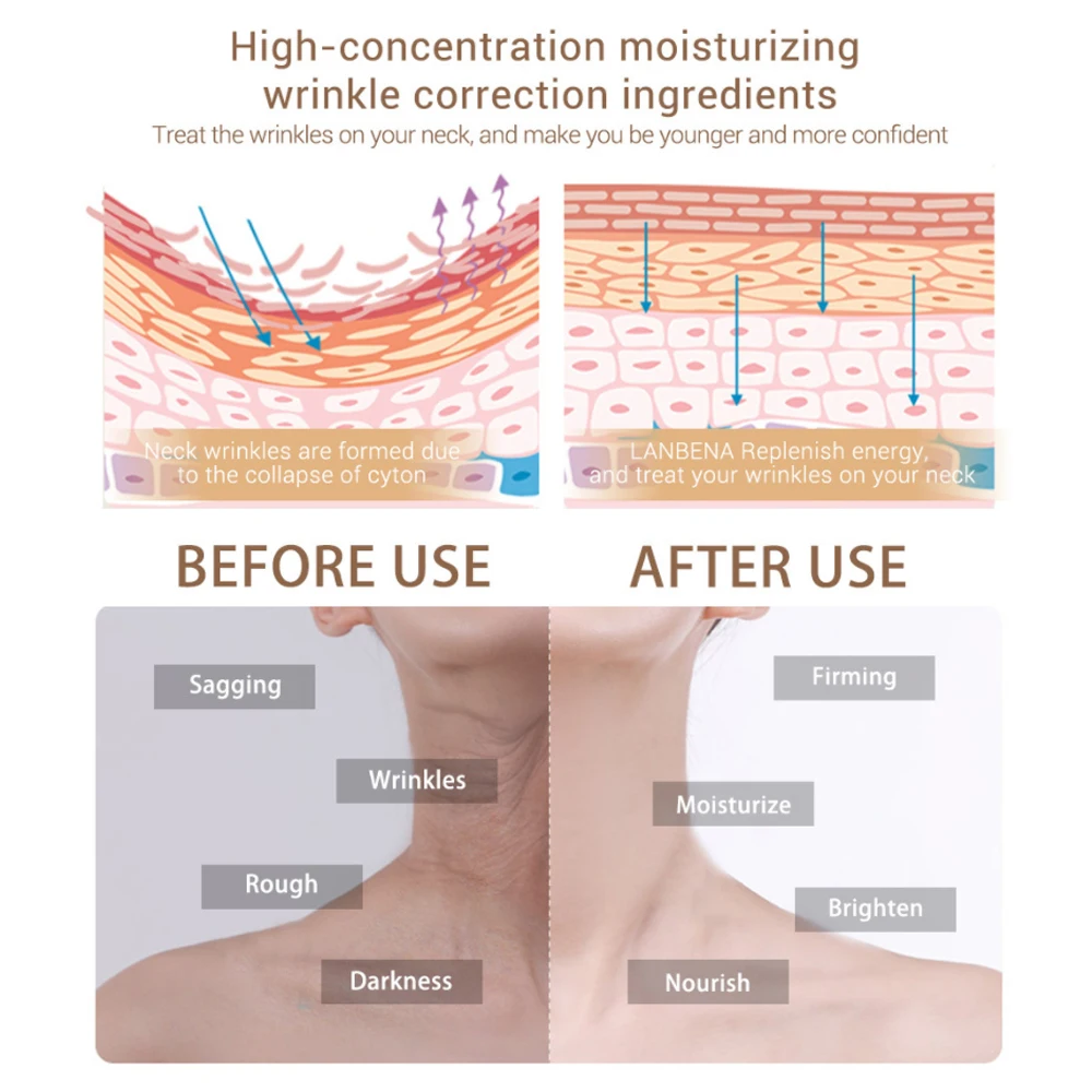 LANBENA отбеливание увлажняющий шеи электромассажер для лица против морщин увлажняющий крем маска для шеи уменьшить тонкие линии снятия Бережный уход за кожей