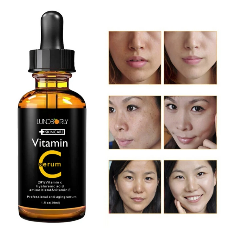 Acne Anti Wrinkle For Skin Care Blemish Facial Cream Vitamin C Serum  Moistening Essence Whitening Serum Green Tea Remove| | - AliExpress