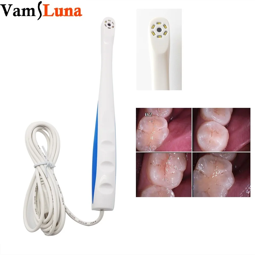 Интраоральная цифровая камера проводная (USB порт) 6 белых светодиодов|dental camera|dental