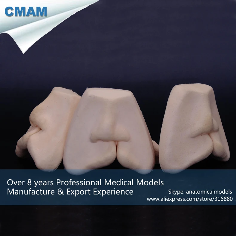 

12588 / Cleft Lip or Anterior Palate Repair Sutures Model,Medical Science Educational Teaching Anatomical Models