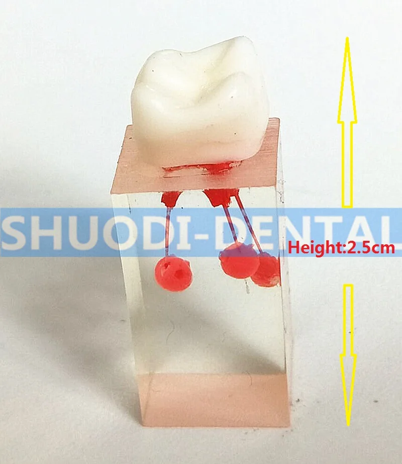 4 шт. 1:1 смолы стоматолога Эндодонтический студент исследование практика Управление модель с цветной корень канала целлюлозы для RCT